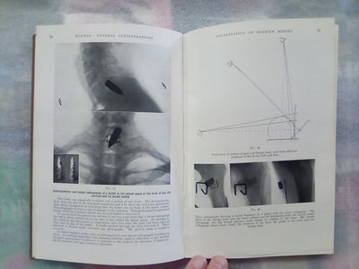 Surgery of Modern Warfare - Third Edition - 6 Volume Set (1944)