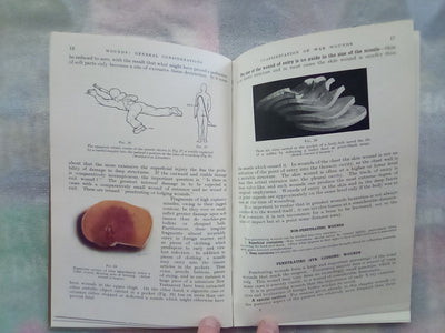 Surgery of Modern Warfare - Third Edition - 6 Volume Set (1944)