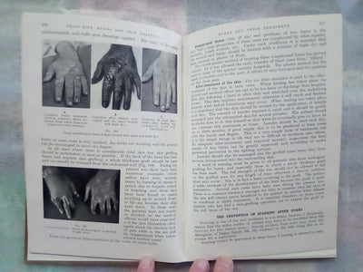 Surgery of Modern Warfare - Third Edition - 6 Volume Set (1944)