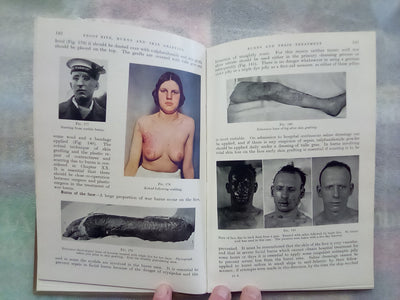 Surgery of Modern Warfare - Third Edition - 6 Volume Set (1944)