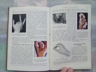 Surgery of Modern Warfare - Third Edition - 6 Volume Set (1944)