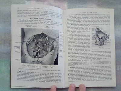 Surgery of Modern Warfare - Third Edition - 6 Volume Set (1944)
