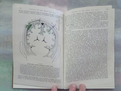 Surgery of Modern Warfare - Third Edition - 6 Volume Set (1944)