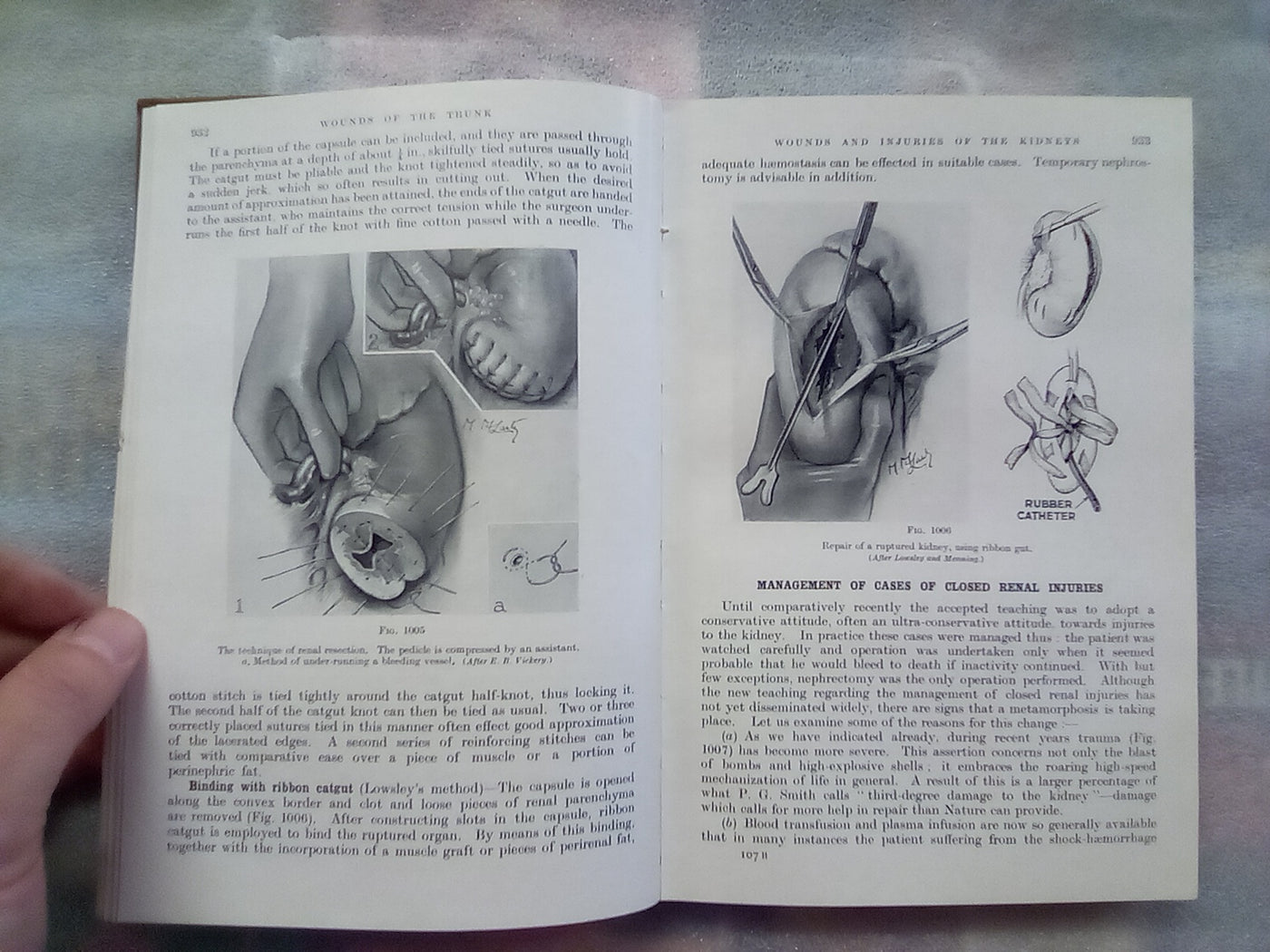 Surgery of Modern Warfare - Third Edition - 6 Volume Set (1944)