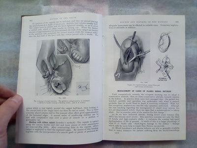 Surgery of Modern Warfare - Third Edition - 6 Volume Set (1944)