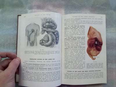 Surgery of Modern Warfare - Third Edition - 6 Volume Set (1944)