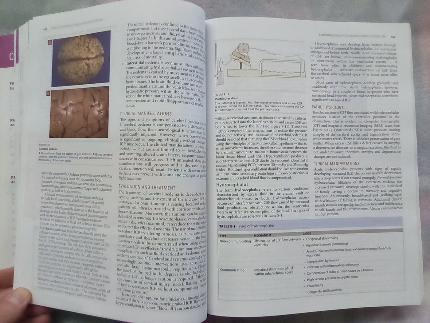 Understanding Pathophysiology 2 (2015 Edition) by Judy Craft & Christopher Gordon