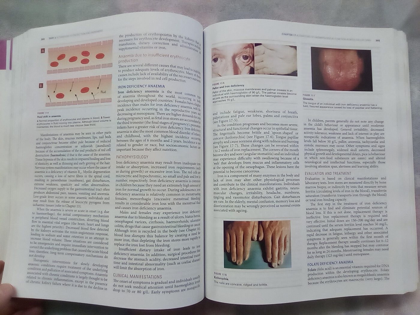 Understanding Pathophysiology 2 (2015 Edition) by Judy Craft & Christopher Gordon