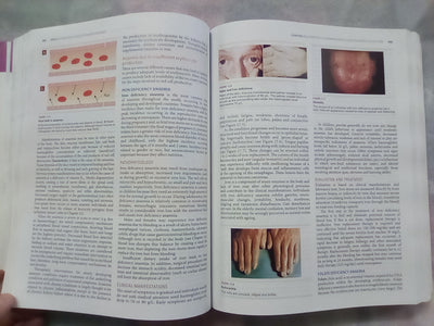 Understanding Pathophysiology 2 (2015 Edition) by Judy Craft & Christopher Gordon