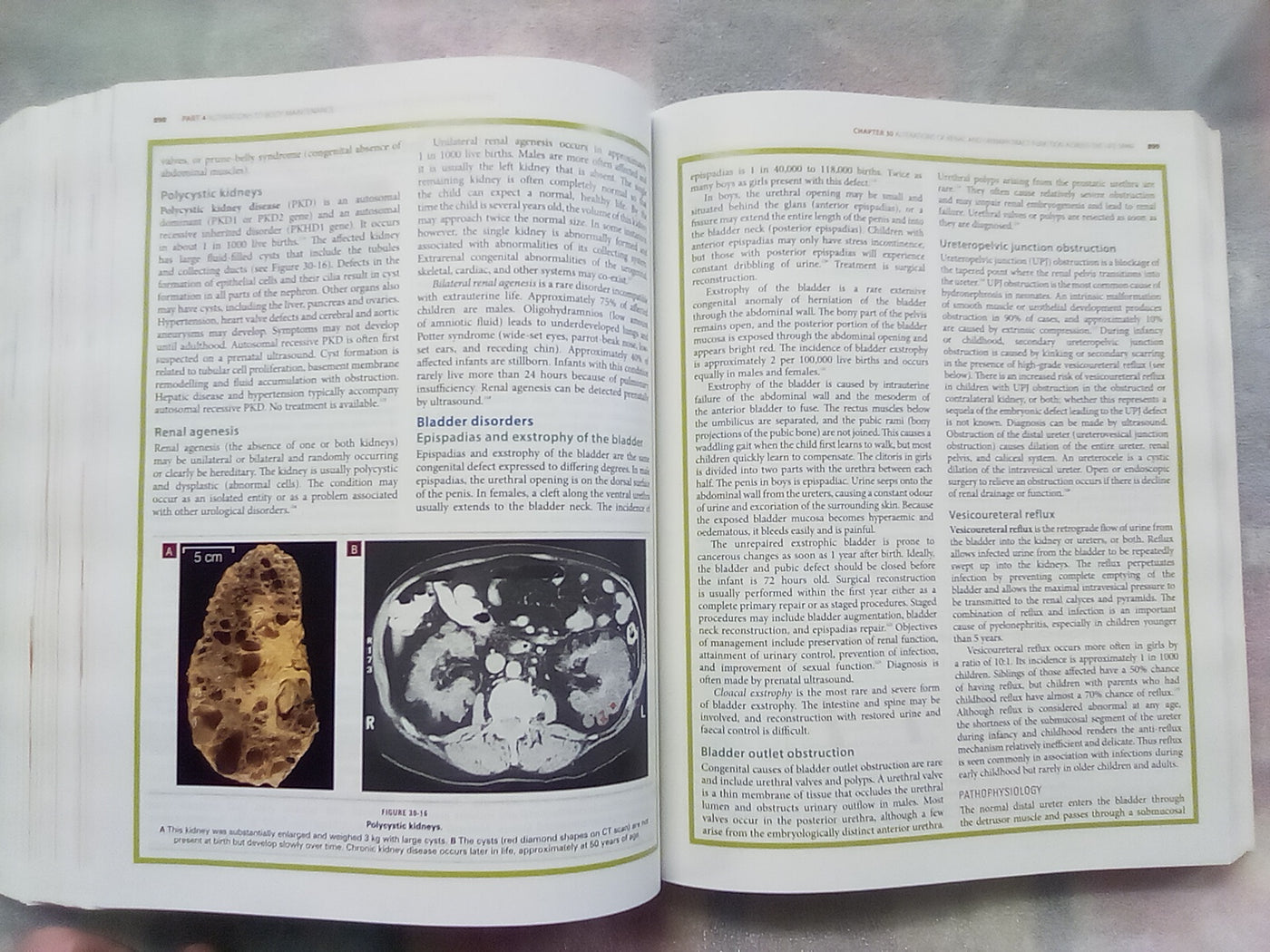 Understanding Pathophysiology 2 (2015 Edition) by Judy Craft & Christopher Gordon