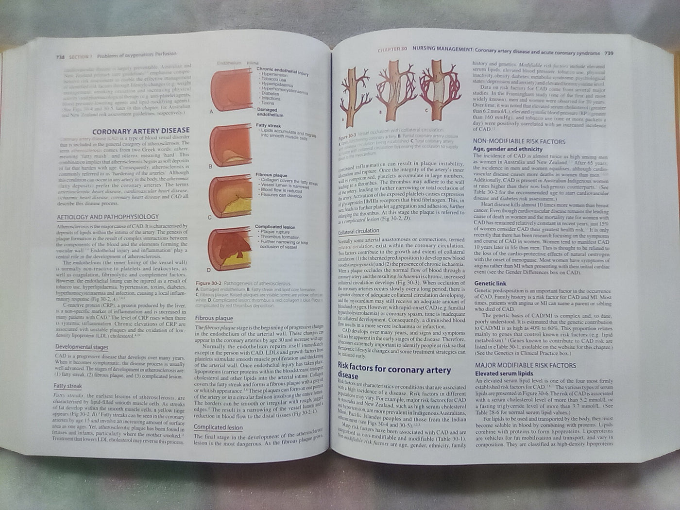 Lewis's Medical Surgical Nursing 4th. Edition