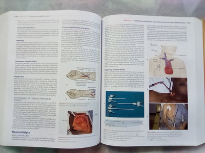 Lewis's Medical Surgical Nursing 4th. Edition